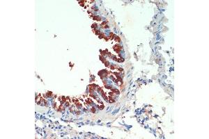 Immunohistochemistry of paraffin-embedded mouse lung using KIF5B antibody (ABIN7268136) at dilution of 1:200 (40x lens). (KIF5B 抗体  (AA 650-770))