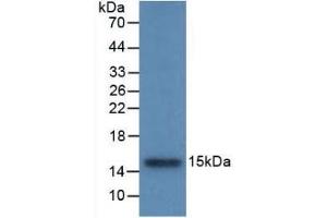 Detection of Recombinant CSTB, Rat using Monoclonal Antibody to Cystatin B (CSTB) (CSTB 抗体  (AA 2-98))