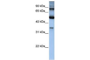 WB Suggested Anti-INPP5B Antibody Titration: 0. (INPP5B 抗体  (Middle Region))