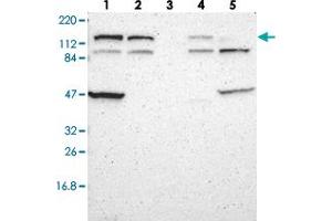 Western blot analysis of Lane 1: RT-4, Lane 2: U-251 MG, Lane 3: Human Plasma, Lane 4: Liver, Lane 5: Tonsil with DIAPH2 polyclonal antibody  at 1:250-1:500 dilution. (DIAPH2 抗体)