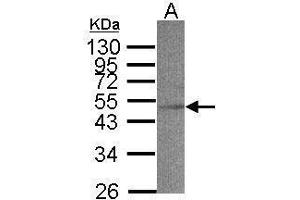 WB Image Sample(30 μg of whole cell lysate) A:MOLT4, 12% SDS PAGE antibody diluted at 1:500 (ACADS 抗体  (N-Term))