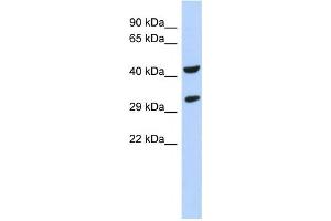 Western Blotting (WB) image for anti-Ankyrin Repeat and SOCS Box Containing 8 (ASB8) antibody (ABIN2459530) (ASB8 抗体)