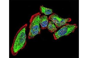Confocal immunofluorescent analysis of Vimentin antibody with A549 cells followed by Alexa Fluor 488-conjugated goat anti-rabbit lgG (green).