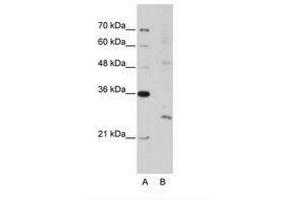 Image no. 3 for anti-Exosome Component 4 (EXOSC4) (N-Term) antibody (ABIN202117) (EXOSC4 抗体  (N-Term))