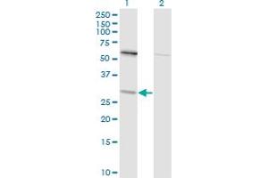 Western Blotting (WB) image for anti-Thiopurine S-Methyltransferase (TPMT) (AA 1-245) antibody (ABIN563239)