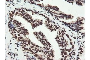 Image no. 11 for anti-Non-POU Domain Containing, Octamer-Binding (NONO) (AA 184-385) antibody (ABIN1491073)