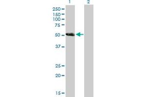 Western Blot analysis of DKFZP779L1558 expression in transfected 293T cell line by DKFZP779L1558 MaxPab polyclonal antibody. (CCDC91 抗体  (AA 1-411))