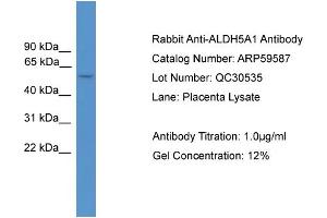 WB Suggested Anti-ALDH5A1  Antibody Titration: 0. (ALDH5A1 抗体  (Middle Region))