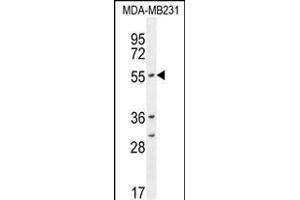 CYP2A7 Antibody (Center) (ABIN654434 and ABIN2844170) western blot analysis in MDA-M cell line lysates (35 μg/lane). (CYP2A7 抗体  (AA 121-148))