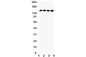 Western Blotting (WB) image for anti-Insulin Receptor Substrate 1 (IRS1) (N-Term) antibody (ABIN3031336)