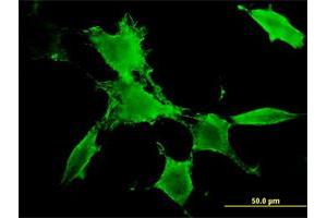 Immunofluorescence (IF) image for anti-PAK3 (PAK3) (AA 1-90) antibody (ABIN518612)