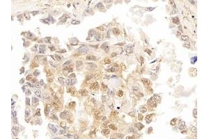 Immunohistochemistry (IHC) image for anti-Galectin 3 (LGALS3) (AA 1-250) antibody (ABIN7431560)