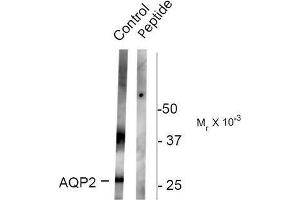 Image no. 1 for anti-Aquaporin 2 (Collecting Duct) (AQP2) (pSer261) antibody (ABIN372590) (AQP2 抗体  (pSer261))
