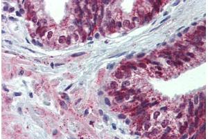 Anti-ALK-1 antibody IHC staining of human prostate.