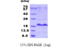 SDS-PAGE (SDS) image for Small Breast Epithelial Mucin (SBEM) (AA 21-90) protein (His tag) (ABIN5778619)