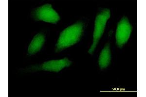 Immunofluorescence of purified MaxPab antibody to RNF34 on HeLa cell. (RNF34 抗体  (AA 1-373))