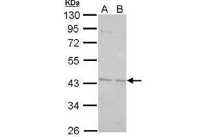 WB Image BRCC45 antibody detects BRE protein by Western blot analysis. (BRE 抗体)