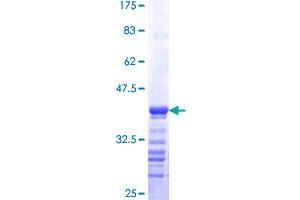 Rhotekin Protein (RTKN) (AA 451-549) (GST tag)