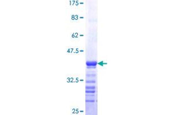 Rhotekin Protein (RTKN) (AA 451-549) (GST tag)