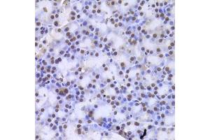 Immunohistochemistry of paraffin-embedded rat pancreas using CSNK1E Antibody. (CK1 epsilon 抗体)
