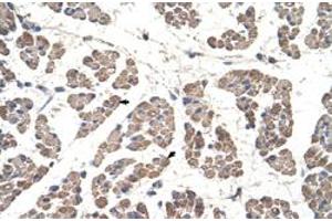 Immunohistochemical staining (Formalin-fixed paraffin-embedded sections) of human muscle with GCDH polyclonal antibody  at 4-8 ug/mL working concentration. (GCDH 抗体  (C-Term))