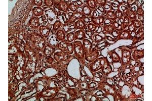 Immunohistochemical analysis of paraffin-embedded Human-kidney, antibody was diluted at 1:100 (EYA1 抗体)