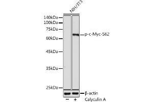 Western blot analysis of extracts of NIH/3T3 cells, using Phospho-c-Myc-S62 antibody (ABIN3019544, ABIN3019545, ABIN3019546 and ABIN6225456) at 1:1000 dilution. (c-MYC 抗体  (pSer62))