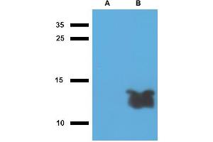 Western blotting analysis of polyclonal anti-Mycobacterium tuberculosis antigen Tb7. (Mycobacterium Tuberculosis Antigen Tb7.7 抗体)