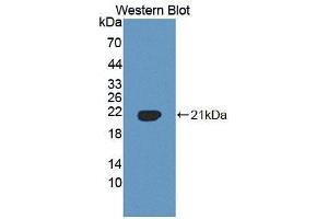 Western blot analysis of the recombinant protein. (PLSCR3 抗体  (AA 99-253))