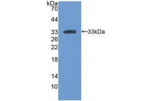 Western blot analysis of recombinant Human LAMa3. (LAMA3 抗体  (AA 47-296))