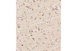 Immunohistochemical analysis of paraffin-embedded Human brain tissue using (ABIN6243263 and ABIN6578971) performed on the Leica® BOND RXm. (MLL2 抗体  (C-Term))