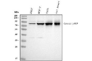 Western blot analysis of gamma Catenin using anti-gamma Catenin antibody (ABIN3043864).