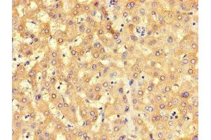 Immunohistochemistry of paraffin-embedded human liver tissue using ABIN7168546 at dilution of 1:100 (BHMT2 抗体  (AA 1-200))