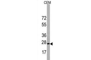 Western blot analysis of BarX1 Antibody (C-term) in CEM cell line lysates (35 μg/lane). (BARX1 抗体  (C-Term))