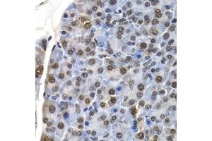 Immunohistochemistry of paraffin-embedded mouse pancreas using ID3 antibody at dilution of 1:200 (400x lens). (ID3 抗体)