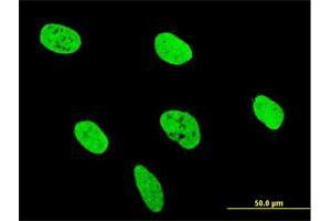 Immunofluorescence of monoclonal antibody to RUNX2 on U-2 OS cell.