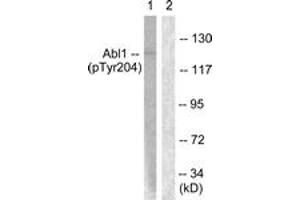 Western blot analysis of extracts from COS7 cells treated with Adriamycin 0. (ABL1 抗体  (pTyr204))