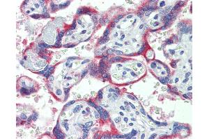 Anti-NOX2 antibody IHC of human placenta. (CYBB 抗体  (AA 151-163))