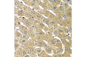Immunohistochemistry of paraffin-embedded human liver injury using TMED10 Antibody (ABIN5974099) at dilution of 1/100 (40x lens). (TMED10 抗体)
