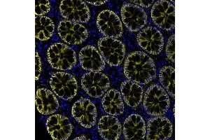 Immunofluorescence (IF) image for anti-Epithelial Cell Adhesion Molecule (EPCAM) (AA 264-314) antibody (ABIN7455204) (Recombinant EpCAM 抗体  (AA 264-314))