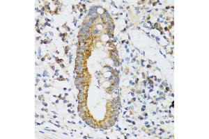 Immunohistochemistry of paraffin-embedded human vermiform appendix using SRP19 antibody (ABIN2560139) at dilution of 1:100 (40x lens). (SRP19 抗体)