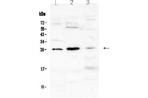 Western blot analysis of Flt3 ligand using anti-Flt3 ligand antibody . (FLT3LG 抗体  (AA 28-189))