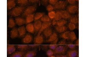 Immunofluorescence (IF) image for anti-NADH Dehydrogenase (Ubiquinone) 1 alpha Subcomplex, Assembly Factor 4 (NDUFAF4) antibody (ABIN7257808)