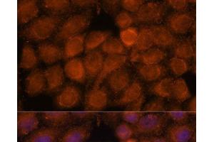 Immunofluorescence analysis of HeLa cells using NDUFAF4 Polyclonal Antibody at dilution of 1:100. (NDUFAF4 抗体)