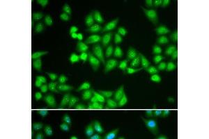 Immunofluorescence analysis of HeLa cells using CHD2 Polyclonal Antibody (CHD2 抗体)