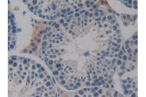 Detection of Flt3 in Mouse Testis Tissue using Polyclonal Antibody to FMS Like Tyrosine Kinase 3 (Flt3) (FLT3 抗体  (AA 335-544))