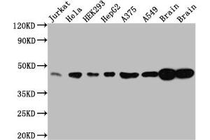 Western Blot Positive WB detected in: Jurkat whole cell lysate, Hela whole cell lysate, HEK293 whole cell lysate, HepG2 whole cell lysate, A375 whole cell lysate, A549 whole cell lysate, Rat Brain whole cell lysate, Mouse Brain whole cell lysate All lanes: ERK2 antibody at 1:1000 Secondary Goat polyclonal to rabbit IgG at 1/50000 dilution Predicted band size: 42, 37 kDa Observed band size: 42 kDa (Recombinant ERK2 抗体)