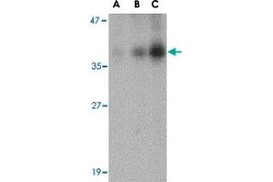 Western blot analysis of DFFB in Jurkat cell lysate with DFFB polyclonal antibody  at (A) 0. (DFFB 抗体  (AA 203-218))