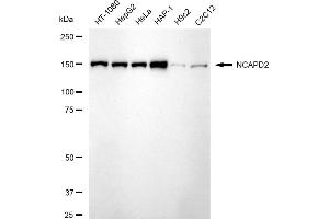 Western blotting analysis using NCAPD2 antibody (ABIN7800957). (Recombinant NCAPD2 抗体)