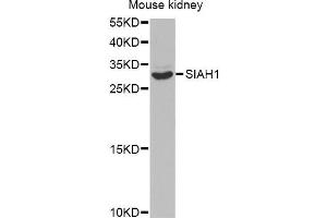 Western blot analysis of extracts of mouse kidney, using SIAH1 antibody (ABIN5971329) at 1/1000 dilution. (SIAH1 抗体)